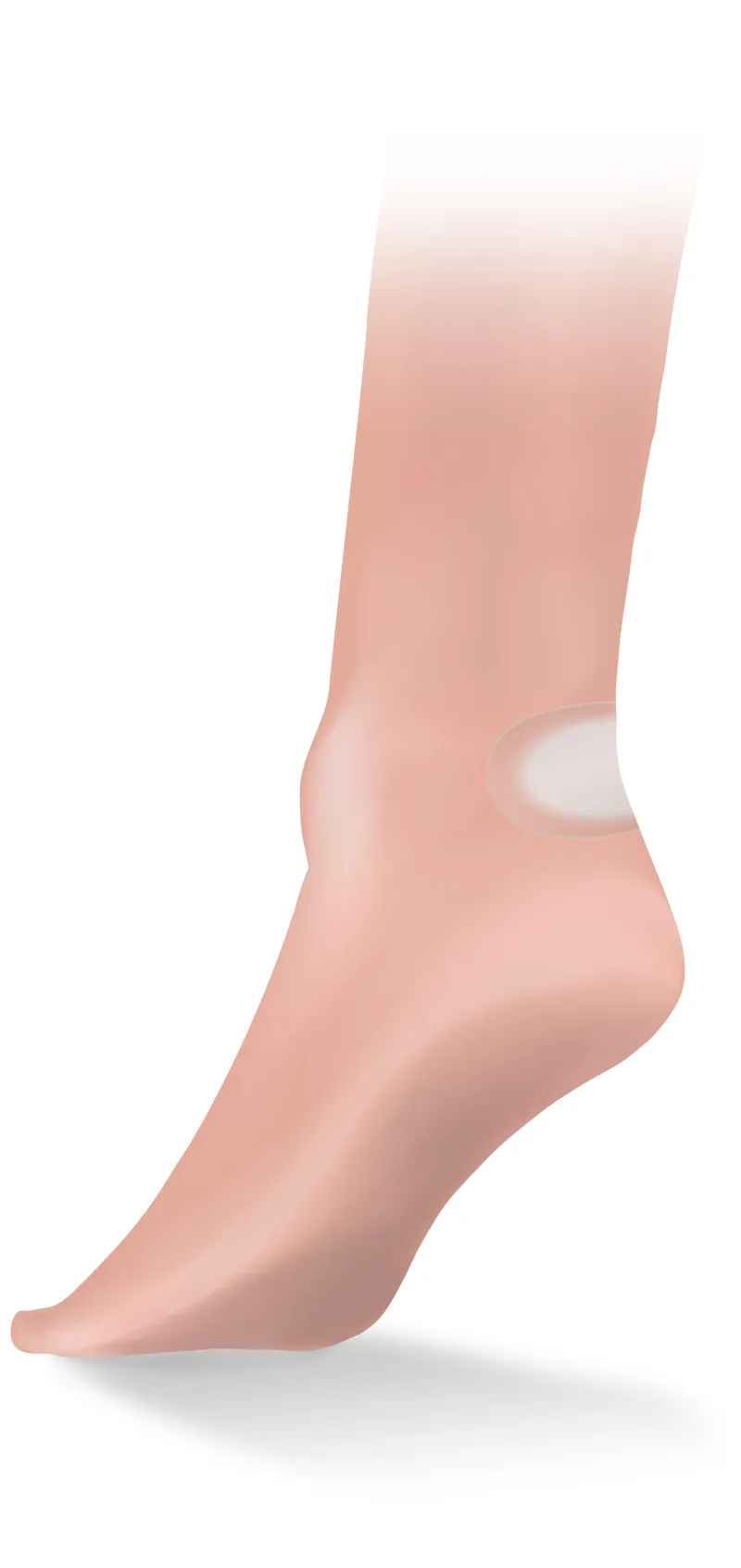 Lifesystems Blister Plasters Pack-4